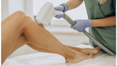 laser hair removal